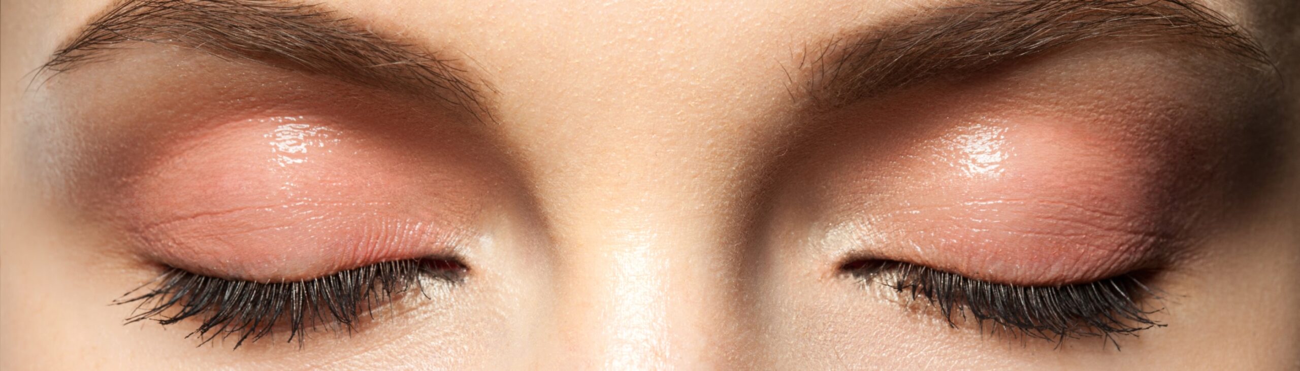 Blépharoplastie supérieure