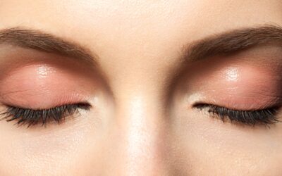 Blépharoplastie supérieure